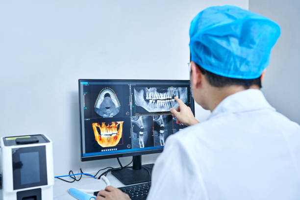 Best Emergency Treatment for Oral Infections in Chula Vista, CA